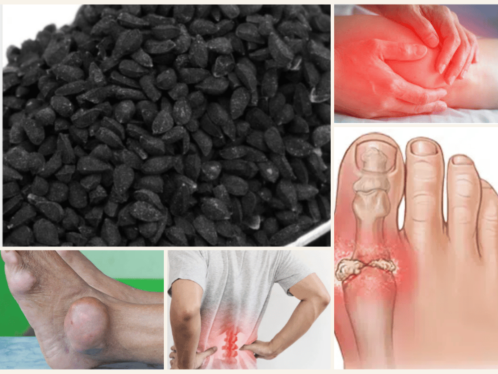 Joint Pain, Gout, and Back Pain: Symptoms, Precautions, and Herbal Management Joint Pain, Gout, and Back Pain Symptoms, Precautions, and Herbal Management