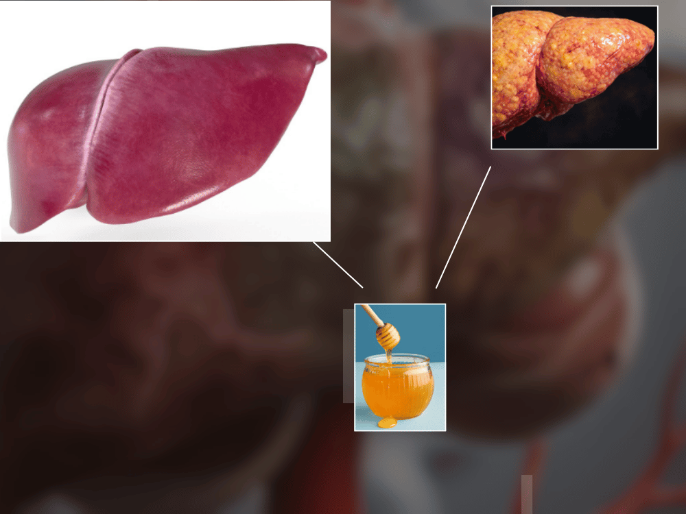 Honey and liver LIVER AND HONEY