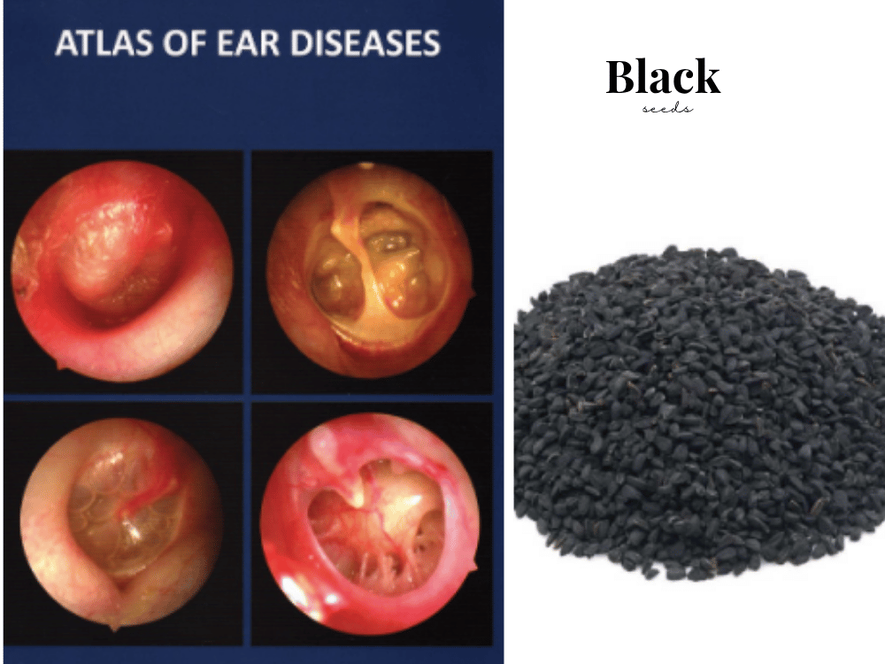 Ear Diseases and Their Traditional Management Ear Diseases and Their Traditional Management
