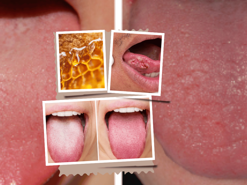 Honey and the Functions of the Tongue and Throat Honey and the Functions of the Tongue and Throat