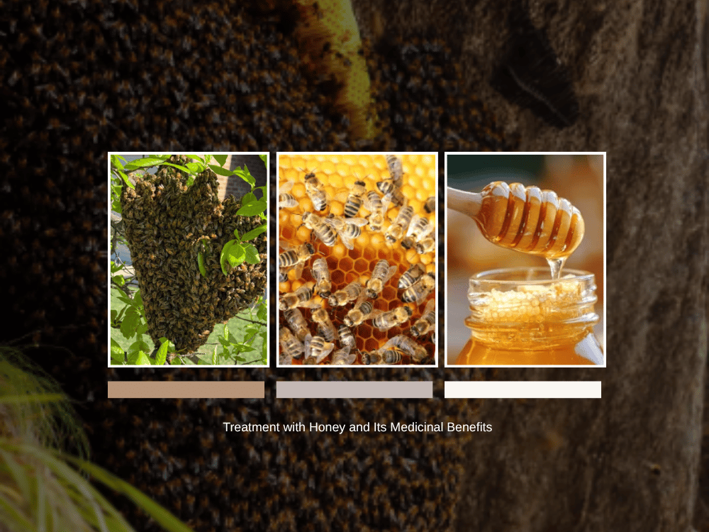 Treatment with Honey and Its Medicinal Benefits Treatment with Honey and Its Medicinal Benefits