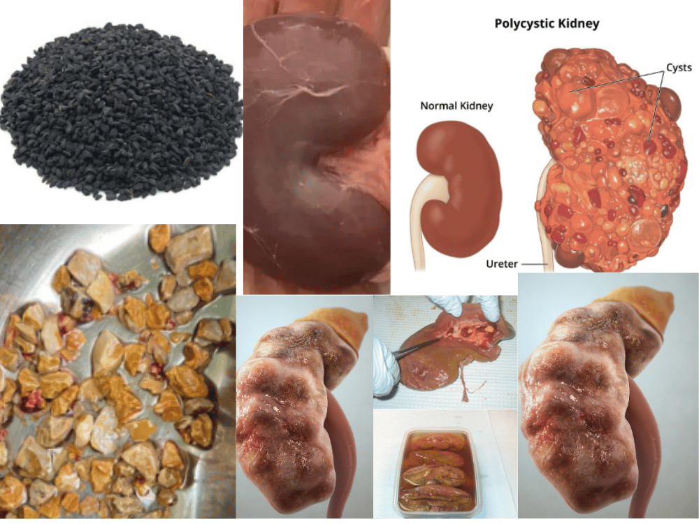 Kidney and Bladder Diseases and Their Traditional Management Kidney and Bladder Diseases and Their Traditional Management