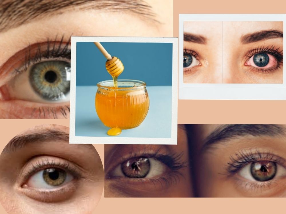 Honey and Eye Function eye disease
