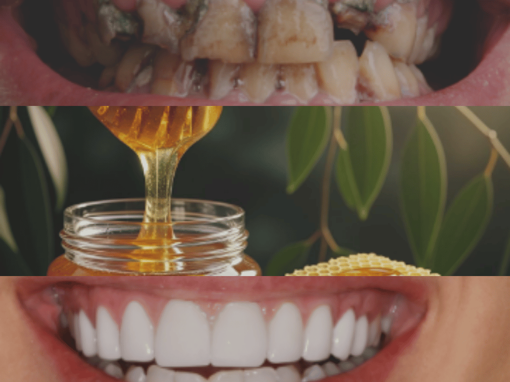 Honey and Our Teeth Honey and Our Teeth