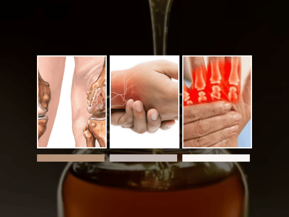 Honey and Joint Diseases Honey and Joint Diseases