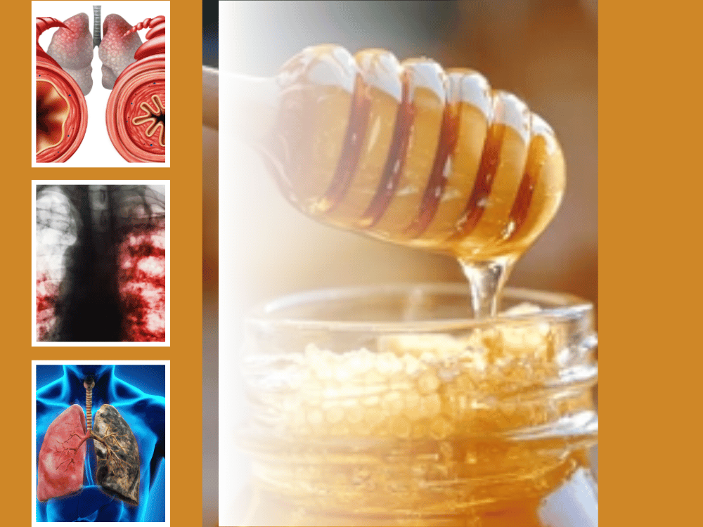 Honey and Lung Function Honey and Lung Function